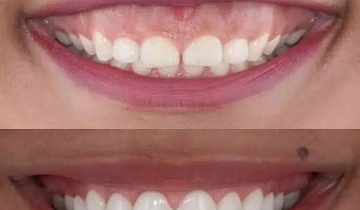 Ajuda na cirurgia da giovana