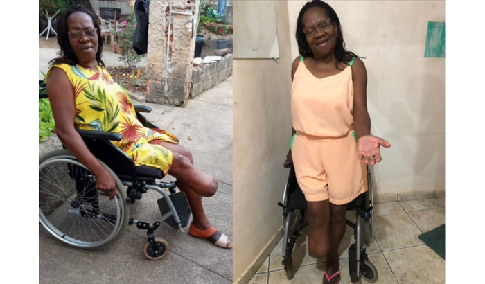 Prótese para mamãe Angélica