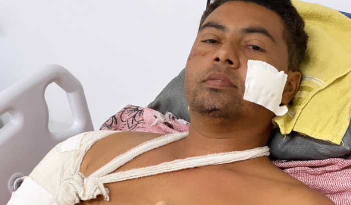 Vakinha para ajudar nosso amigo Michell