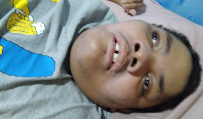 Ajudar meu filho que tem Paralisia Cerebral G80 F79