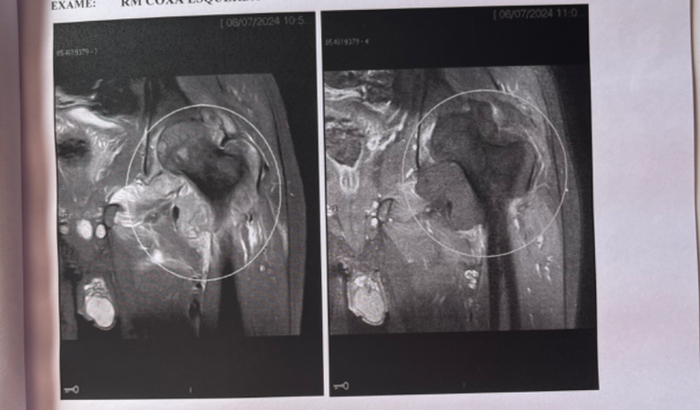 Ajuda para nosso amigo Jeferson