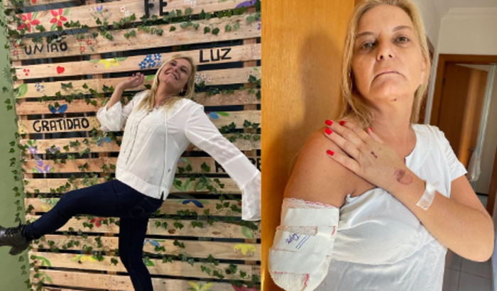 Ajude a Simone em sua recuperação e na conquista de sua Prótese 
