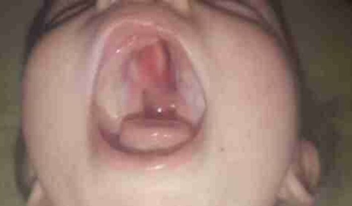 Fórmula infantil especial 