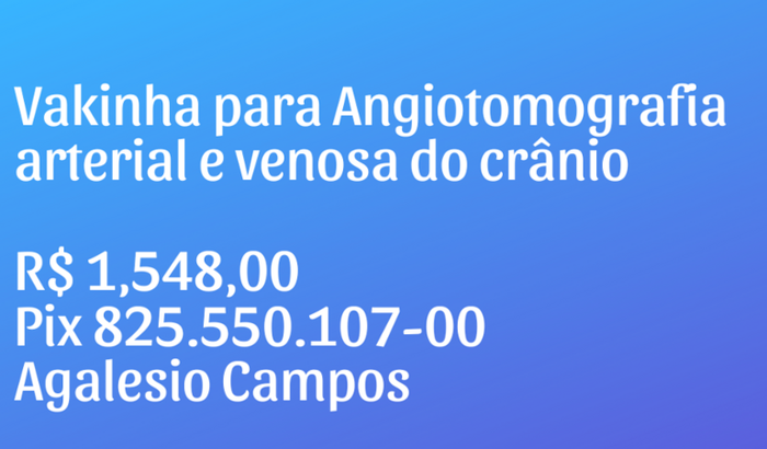 Angiotomografia arterial e venosa do crânio