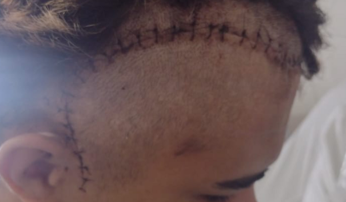 Tumor Maligno na Cabeça Nos ajude a pagar Meus Exames