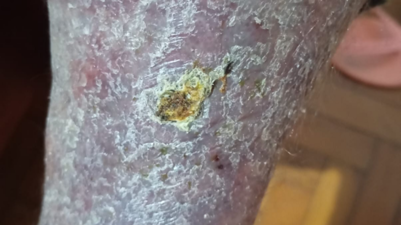 Ajuda cirurgia da Marli 