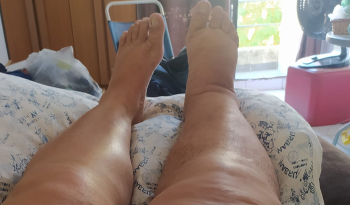 Ajude a Lela na luta contra um Linfoma não hodgkin