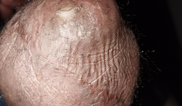 Ajuda pra comprar pé de amortecedor 