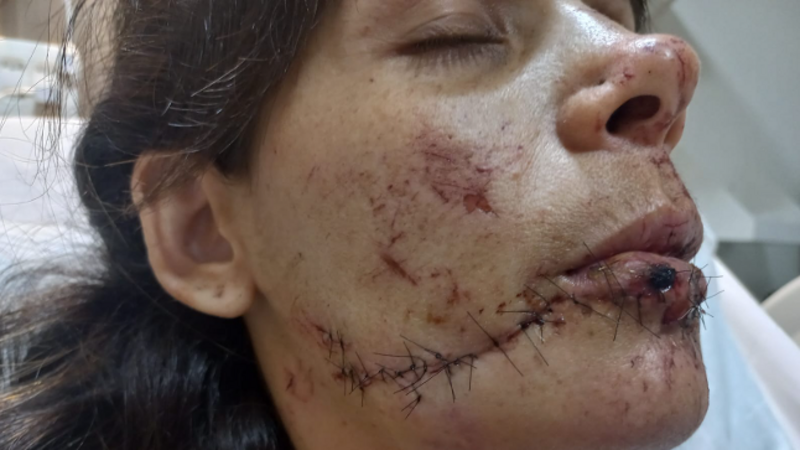 imagem da vaquinha Ajude Rebeca a sorrir completo