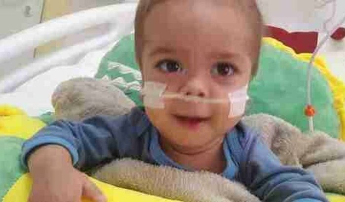 Doença rara gangliosidose GM 1