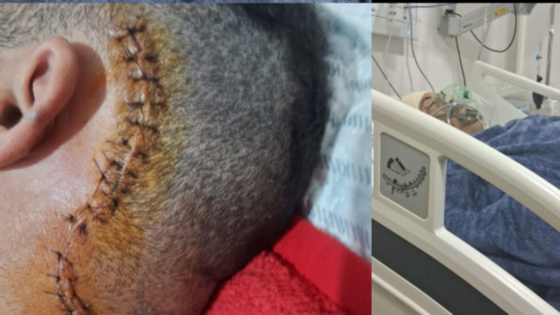 Pagar  Cirurgia  Da neuralgia do trigemio
