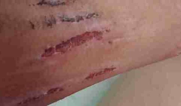 Pra mim comprar coisas pra casa e revender pois estou com depressão crise de panico e ansiedade  s