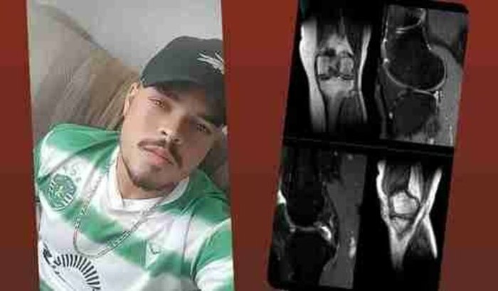 Pós cirurgia do LCA e Menisco medial Douglas