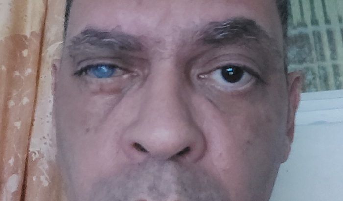 Ajuda para comprar Alimentos e Ração 