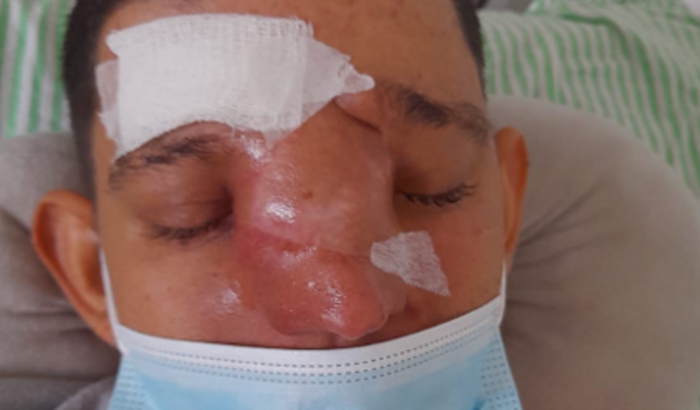 Alister Santos da Silva