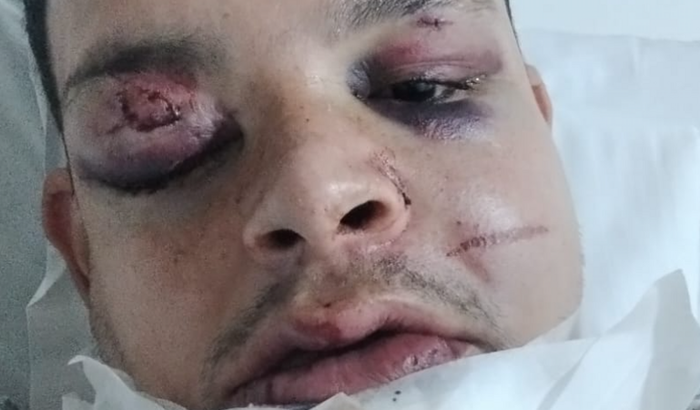 Ajudando o cozinheiro Alan a se recuperar !!