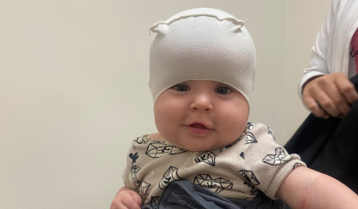 Ajude a Cecilia com sua Órtese Craniana