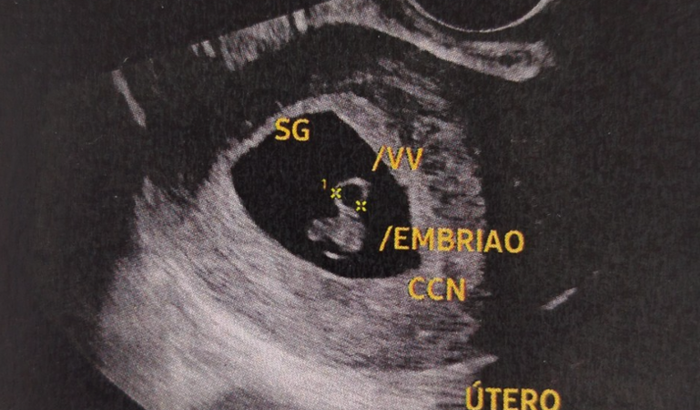 Ajude-nos a Casar ❤️