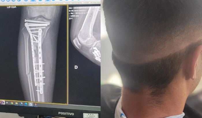 Ajuda pra comprar um máquina de acabamento 