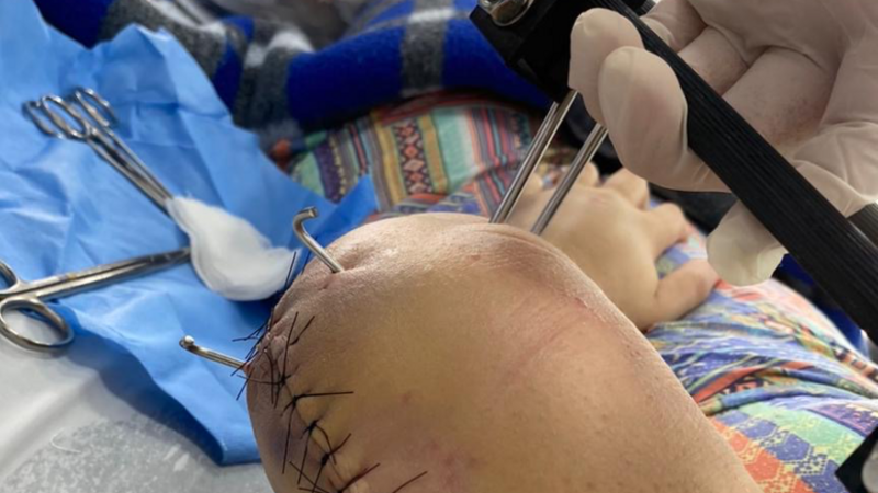 Ajuda custos Cirurgia 