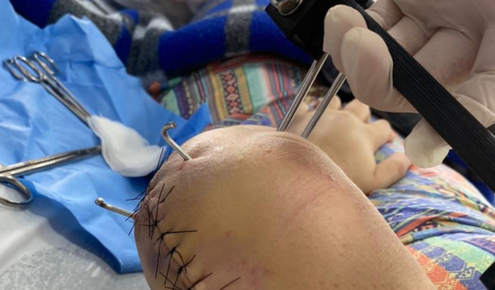 Ajuda custos Cirurgia 