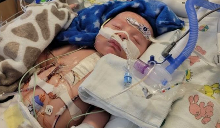 Criança com tumor avançado no crânio precisa Precisa da cirurgia urgente para sobreviver