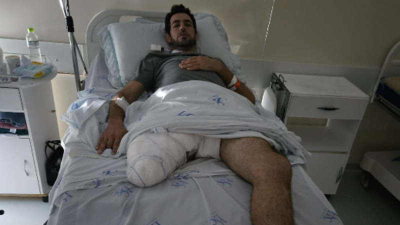 Ajude o Douglas a comprar uma prótese e voltar a andar!