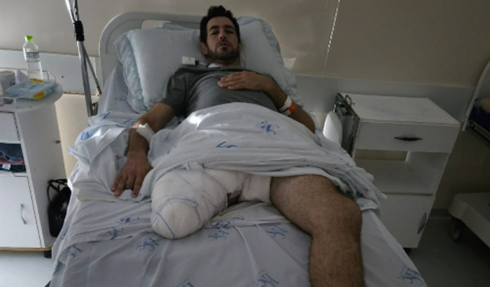 Ajude o Douglas a comprar uma prótese e voltar a andar!