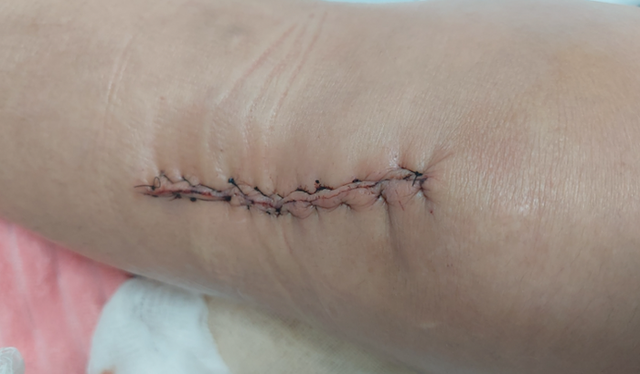 Vakinha solidária cirurgia joelho esquerdo