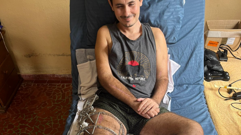 Ajuda Cirurgia do Plexo Braquial Thiago Montemor