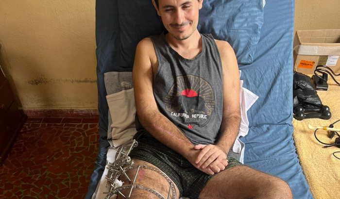 Ajuda Cirurgia do Plexo Braquial Thiago Montemor