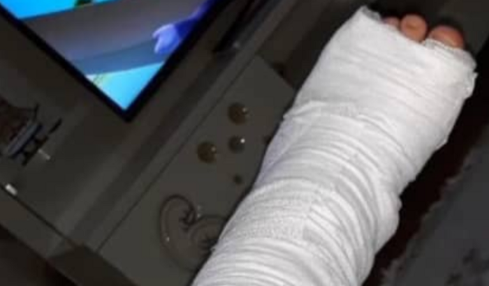 Ajuda para um amigo operar a perna