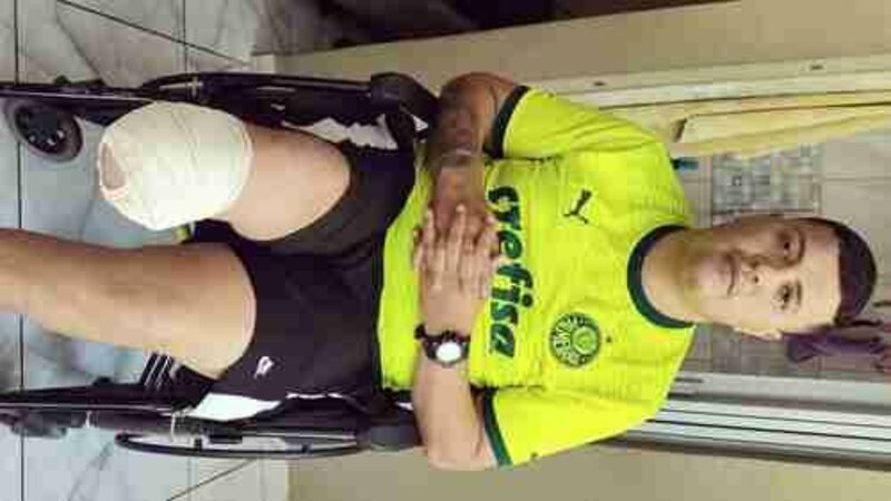 Ajudar a comprar minha prótese do pé 