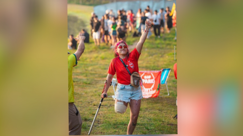 Ajuda para comprar uma prótese transfemoral 