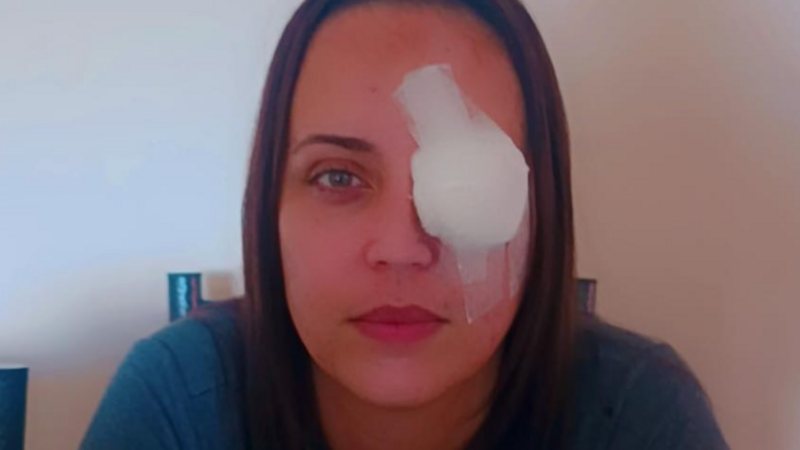 Ajude na cirurgia de Michele