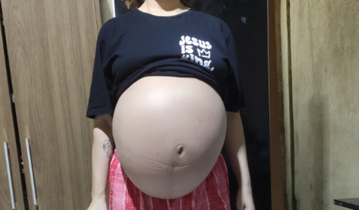 Cirurgia urgente para salvar minha vida