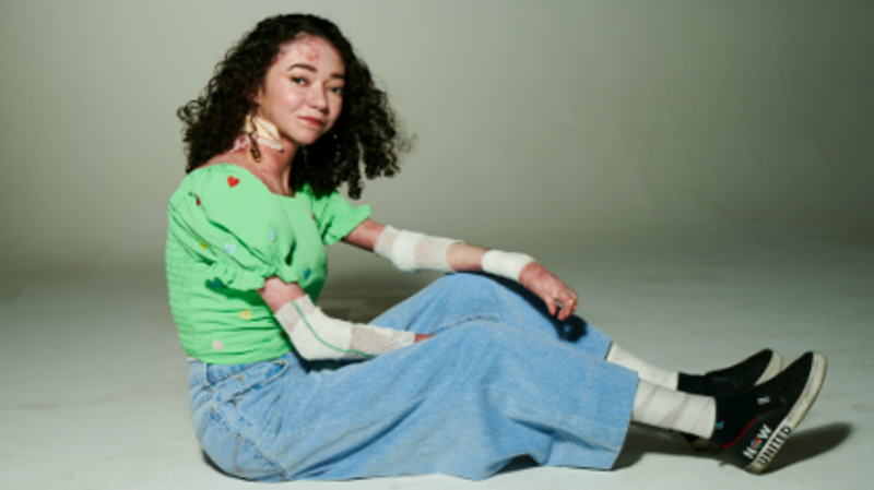 Curativos para Larissa Miranda - Epidermólise Bolhosa