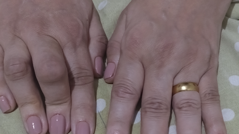 TRATAMENTO PARA SAÚDE 