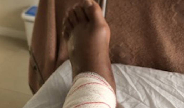 Vaquinha solidária, para compra de uma BOTA ORTOPEDICA + MULETA