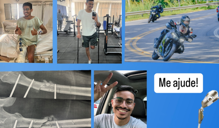 Prótese para Lucas Menino