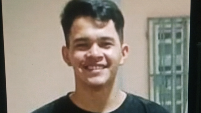 Cirurgia para retirada de tumor cerebral 