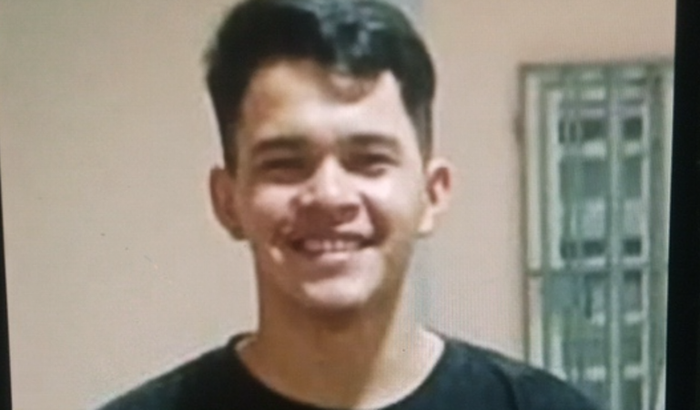 Cirurgia para retirada de tumor cerebral 