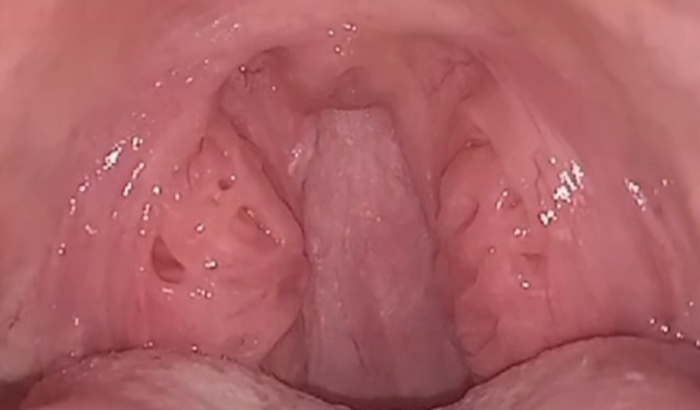 Vaquinha solidária, para realizaçao de cirurgia nas amígdalas