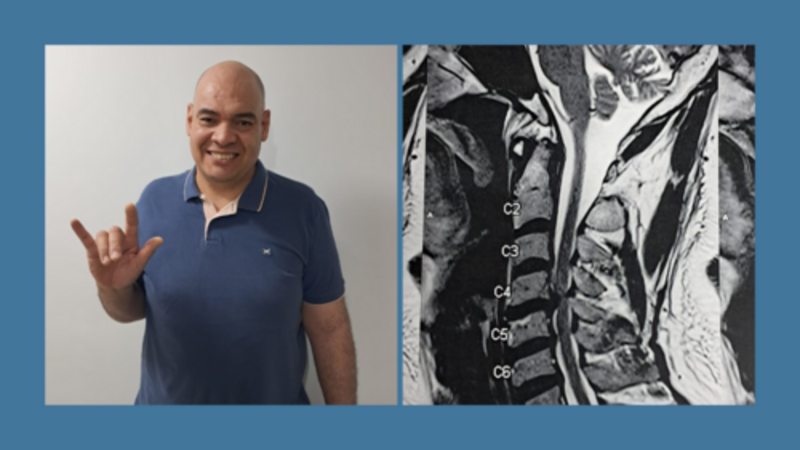 Juntos pela cirurgia do Silvano