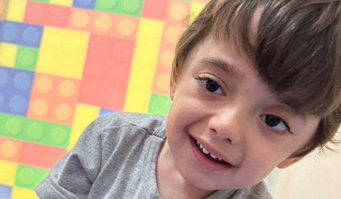 Cirurgias troca de válvulas hidrocefalia