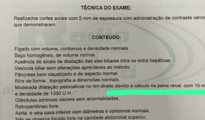 CIRURGIA RENAL (Litotripsia)