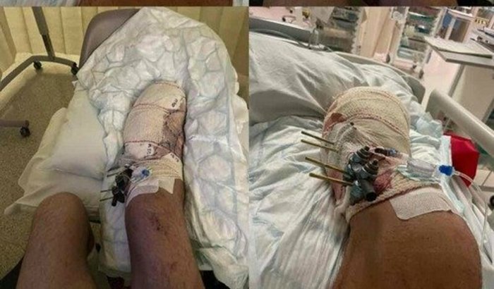 Vakinha / custear despesas do acidente do Lucas