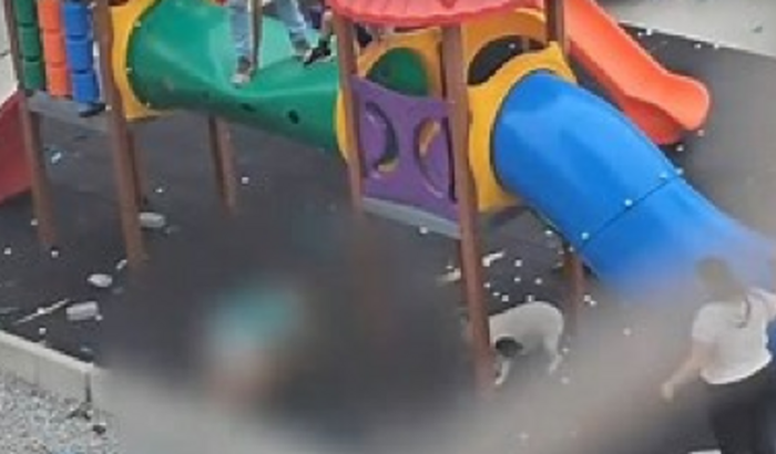 Vaquinha Solidária para criança atacada pelo pitbull no parquinho
