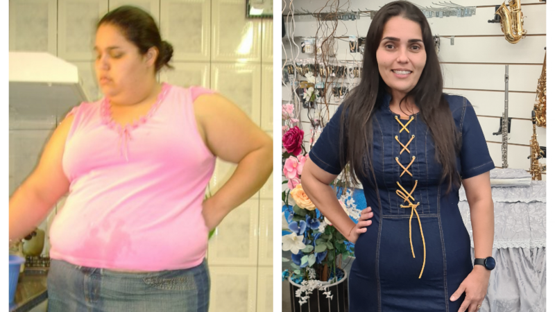 Retirada de pele PryMazzei, após eliminar 71kg