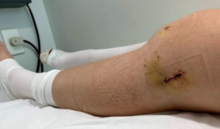 Ajude Maria Luiza a realizar uma cirurgia de emergência no joelho!